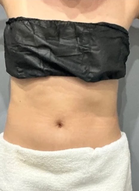 Resultado Después del tratamiento